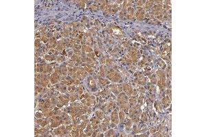 Immunohistochemical staining of human pancreas with TOM1 polyclonal antibody  shows moderate cytoplasmic positivity in exocrine glandular cells.