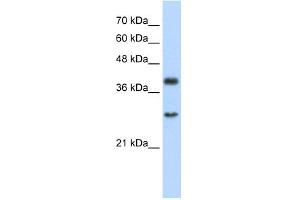 WB Suggested Anti-WDR39 Antibody Titration:  2. (CIAO1 Antikörper  (C-Term))