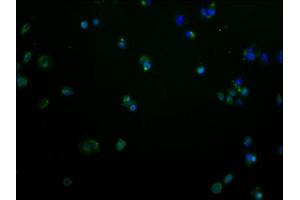 Immunofluorescence staining of MCF-7 cells with ABIN7139980 at 1:100, counter-stained with DAPI. (OR2M2 Antikörper  (AA 259-273))