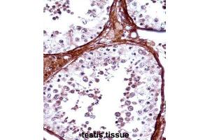Immunohistochemistry (IHC) image for anti-T-Box 5 (TBX5) antibody (ABIN2998161) (T-Box 5 Antikörper)