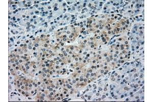 Immunohistochemical staining of paraffin-embedded Ovary tissue using anti-NRBP1mouse monoclonal antibody. (NRBP1 Antikörper)