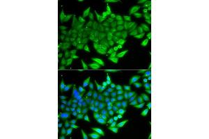 Immunofluorescence analysis of A549 cells using TTF2 antibody (ABIN5975177). (TTF2 Antikörper)