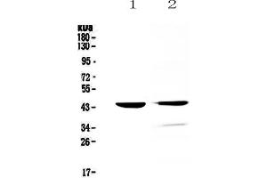 Western blot analysis of Cathepsin D using anti-Cathepsin D antibody .