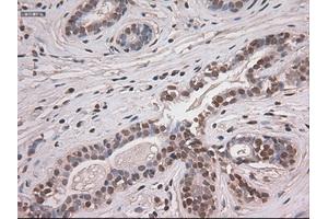 Immunohistochemical staining of paraffin-embedded breast tissue using anti-NOTCH1 mouse monoclonal antibody. (Notch1 Antikörper  (AA 2300-2556))