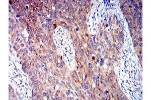 Immunohistochemistry (IHC) image for anti-Pyrimidinergic Receptor P2Y, G-Protein Coupled, 4 (P2RY4) antibody (ABIN5611351)