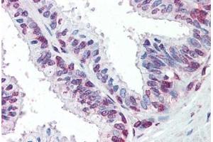 Human Prostate: Formalin-Fixed, Paraffin-Embedded (FFPE) (ZIC3 Antikörper  (AA 178-189))