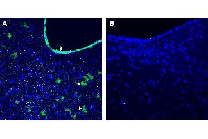 Expression of GFRAL in rat nucleus of the solitary tract.