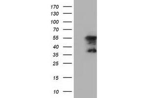 HEK293T cells were transfected with the pCMV6-ENTRY control (Left lane) or pCMV6-ENTRY DYNC1LI1 (Right lane) cDNA for 48 hrs and lysed. (DYNC1LI1 Antikörper)