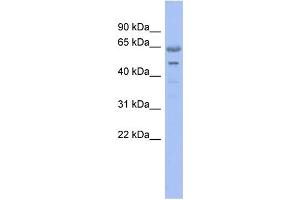 WB Suggested Anti-GNL3 Antibody Titration: 0. (Nucleostemin Antikörper  (N-Term))