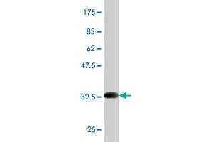 Western Blot detection against Immunogen (33. (SCN9A Antikörper  (AA 269-339))