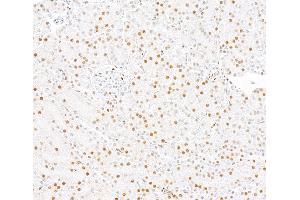 Immunohistochemistry (IHC) image for anti-SWI/SNF Related, Matrix Associated, Actin Dependent Regulator of Chromatin, Subfamily A, Member 2 (SMARCA2) (AA 100-150) antibody (ABIN7795710)