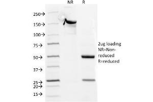 SDS-PAGE Analysis Purified CD5 Mouse Monoclonal Antibody (CD5/54/F6). (CD5 Antikörper)