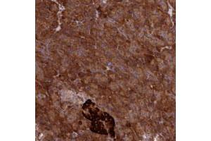 Immunohistochemical staining of human pancreas with DDX60L polyclonal antibody  shows strong cytoplasmic positivity in exocrine glandular cells at 1:50-1:200 dilution. (DDX60L Antikörper)