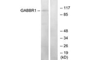 Western blot analysis of extracts from K562 cells, using GABBR1 Antibody. (GABBR1 Antikörper  (AA 891-940))