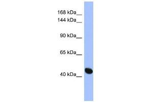 WB Suggested Anti-RASGRF1 Antibody Titration: 0.