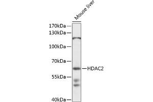 Western blot analysis of extracts of mouse liver, using HD antibody  at 1:1000 dilution. (HDAC2 Antikörper  (AA 429-488))