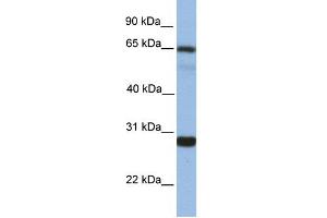 WB Suggested Anti-MED4 Antibody Titration:  1 ug/ml  Positive Control:  Fetal liver cell lysate