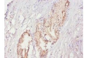 Immunohistochemistry of paraffin-embedded human prostate tissue using ABIN7164895 at dilution of 1:20 (ACPP Antikörper  (AA 38-386))