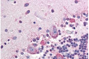 Human Brain, Cerebellum (formalin-fixed, paraffin-embedded) stained with ALPP antibody ABIN296659 at 10 ug/ml followed by biotinylated anti-mouse IgG secondary antibody ABIN481714, alkaline phosphatase-streptavidin and chromogen. (PLAP Antikörper)