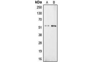 Western blot analysis of Carboxypeptidase E expression in NIH3T3 (A), PC12 (B) whole cell lysates. (CPE Antikörper  (Center))