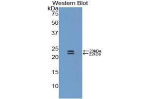 Western blot analysis of the recombinant protein. (BMP1 Antikörper  (AA 856-982))