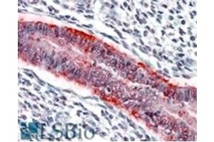 Image no. 1 for anti-Matrix Metallopeptidase 7 (Matrilysin, Uterine) (MMP7) (C-Term) antibody (ABIN374597) (MMP7 Antikörper  (C-Term))
