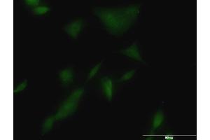 Immunofluorescence of monoclonal antibody to KLK3 on A-549 cell. (Prostate Specific Antigen Antikörper  (AA 1-261))
