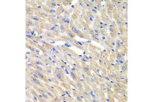 Immunohistochemistry of paraffin-embedded mouse heart using CARS antibody at dilution of 1:100 (x40 lens). (CARS Antikörper)