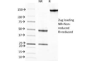 SDS-PAGE Analysis Purified RBP1 Mouse Monoclonal Antibody (G4E4). (RBP4 Antikörper)