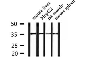 Western blot analysis of extracts from mouse liver and HepG2 and rat muscle and mouse spleen, using OR4F15 Antibody. (OR4F15 Antikörper)