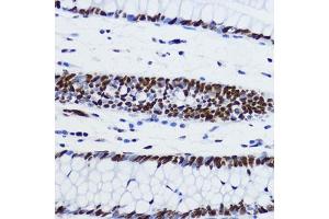 Immunohistochemistry of paraffin-embedded human colon using Acetyl-Histone H2B-K12 antibody (ABIN7267731) at dilution of 1:200 (40x lens). (Histone H2B Antikörper  (acLys12))