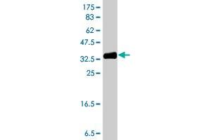 Western Blot detection against Immunogen (38. (PFKFB3 Antikörper  (AA 412-520))