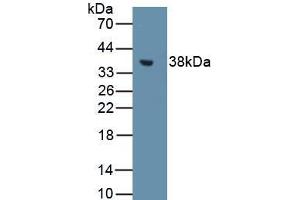 Western Blot Sample: Recombinant MT1, Rat (MT1 Antikörper  (AA 1-61))