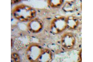 Used in DAB staining on fromalin fixed paraffin-embedded Kidney tissue (EGF Antikörper  (AA 977-1029))