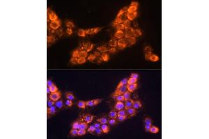 Immunofluorescence analysis of  cells using L Polyclonal Antibody (ABIN6128174, ABIN6143076, ABIN6143077 and ABIN6219002) at dilution of 1:100 (40x lens). (LAMC2 Antikörper  (AA 862-1111))
