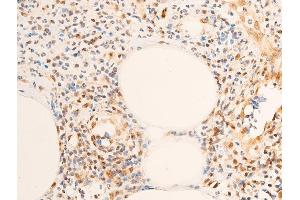 ABIN6256630 and ABIN6267283 at 1/100 staining rat appendiceal tissue sections by IHC-P.