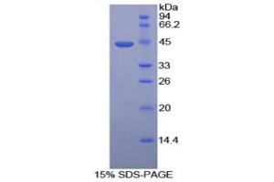 SDS-PAGE (SDS) image for Hyaluronidase-2 (HYAL2) (AA 23-447) protein (His tag) (ABIN1079889)