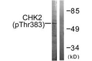 Western blot analysis of extracts from COS7 cells treated with UV 30', using Chk2 (Phospho-Thr383) Antibody. (CHEK2 Antikörper  (pThr383))