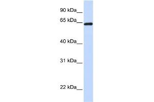 WB Suggested Anti-LCP1 Antibody Titration: 0. (LCP1 Antikörper  (C-Term))