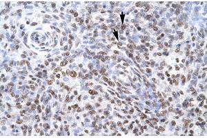 Human Spleen; ZNF500 antibody - middle region in Human Spleen cells using Immunohistochemistry (ZNF500 Antikörper  (Middle Region))