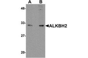 Western blot analysis of ALKBH2 in human kidney tissue lysate with ALKBH2 antibody at (A) 1 and (B) 2 μg/ml. (ALKBH2 Antikörper  (C-Term))