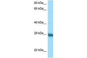 WB Suggested Anti-TFPI Antibody Titration: 1.