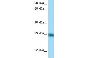 WB Suggested Anti-TFPI Antibody Titration: 1. (TFPI Antikörper  (C-Term))