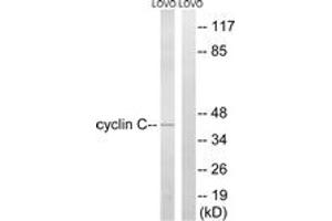 Western blot analysis of extracts from LOVO cells, using Cyclin C (Ab-275) Antibody. (Cyclin C Antikörper  (AA 234-283))