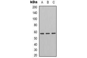 Western blot analysis of GRP58 expression in HT29 (A), K562 (B), A549 (C) whole cell lysates. (PDIA3 Antikörper)