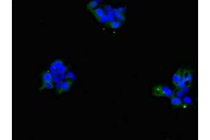 Immunofluorescent analysis of 293 cells using ABIN7169906 at dilution of 1:100 and Alexa Fluor 488-congugated AffiniPure Goat Anti-Rabbit IgG(H+L) (SLC4A7 Antikörper  (AA 240-400))