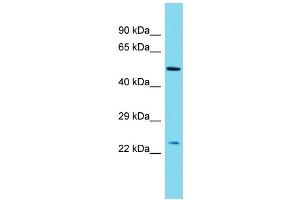 Host: Rabbit Target Name: MBD3L2 Sample Type: Placenta lysates Antibody Dilution: 1.