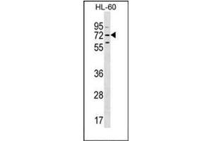 Western blot analysis of MBTD1 Antibody (C-term) in HL-60 cell line lysates (35ug/lane). (MBTD1 Antikörper  (C-Term))