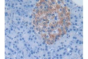 Immunohistochemistry (IHC) image for anti-Dimethylarginine Dimethylaminohydrolase 1 (DDAH1) (AA 20-215) antibody (ABIN7435685)