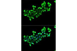 Immunofluorescence analysis of U2OS cells using FLOT1 antibody. (Flotillin 1 Antikörper  (AA 128-427))